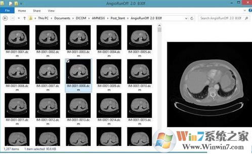 DICOM Thumbnailer(DICOM缩略图查看器)v1.10.5绿色版